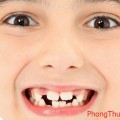 Những điềm báo bất ngờ đằng sau giấc mơ về răng miệng
